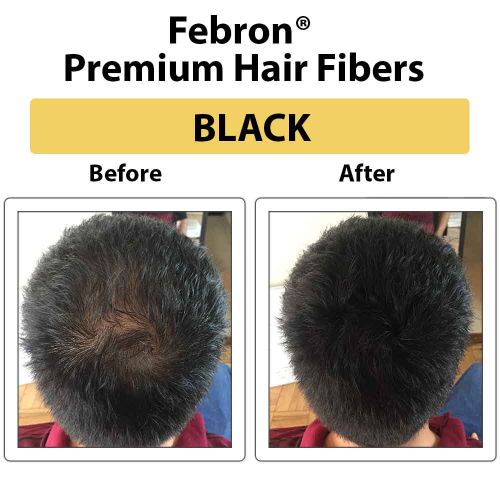 3 IN 1 Premium Febron Hair Building Fibers | Febron