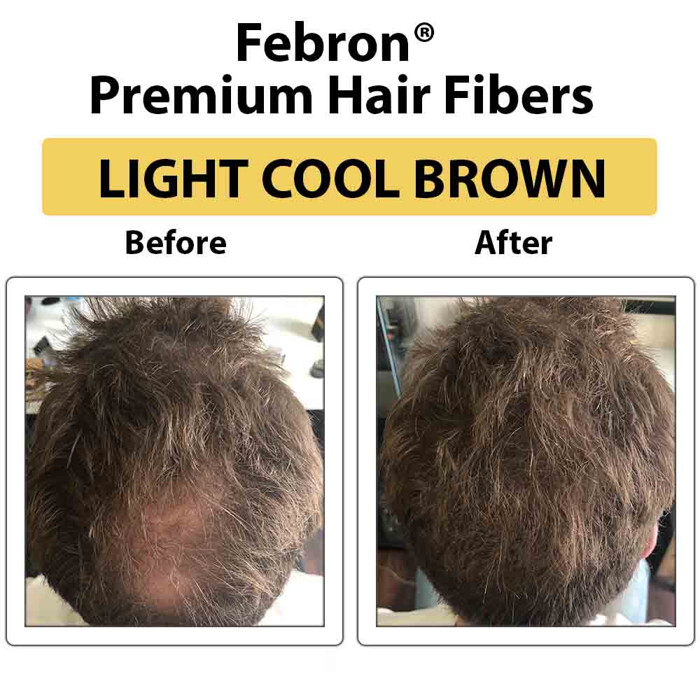 Febron® SILVER KIT 10% OFF | Hair Thickening Fibers Kit