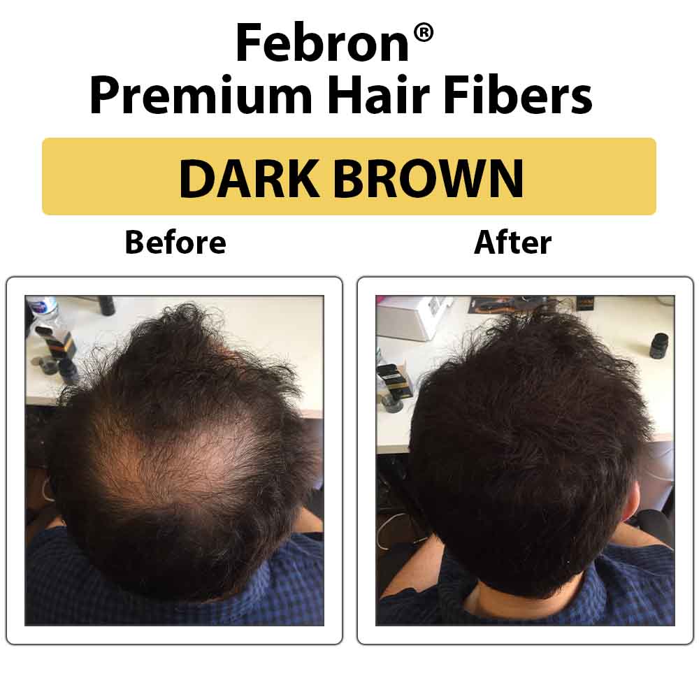Febron® SILVER KIT 10% OFF | Hair Thickening Fibers Kit