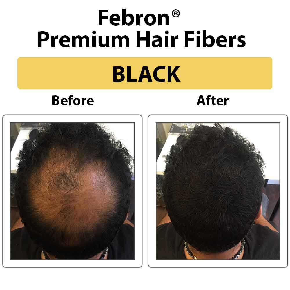 Febron® SILVER KIT 10% OFF | Hair Thickening Fibers Kit