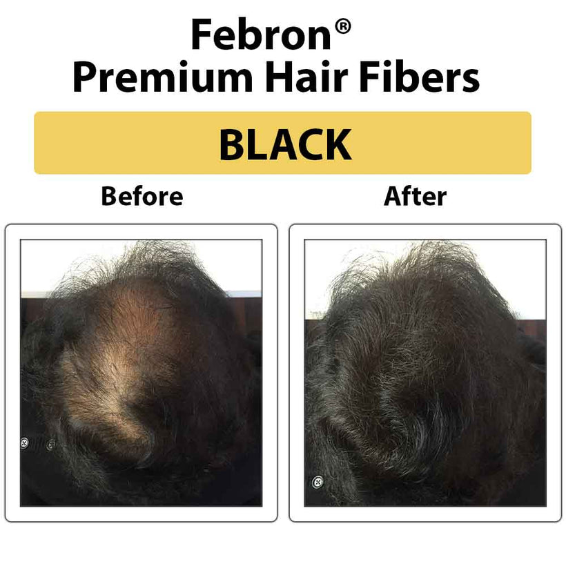 3 IN 1 Premium Febron Hair Building Fibers | Febron