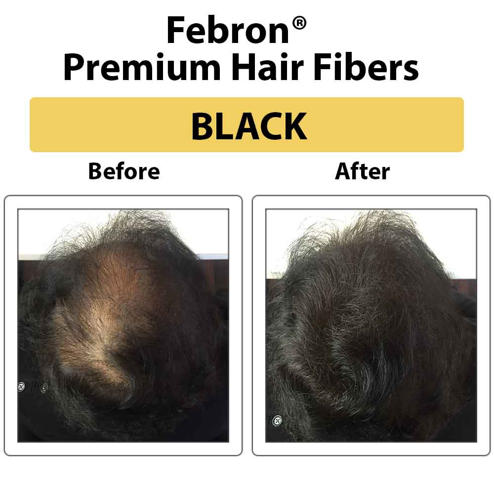 Febron® SILVER KIT 10% OFF | Hair Thickening Fibers Kit
