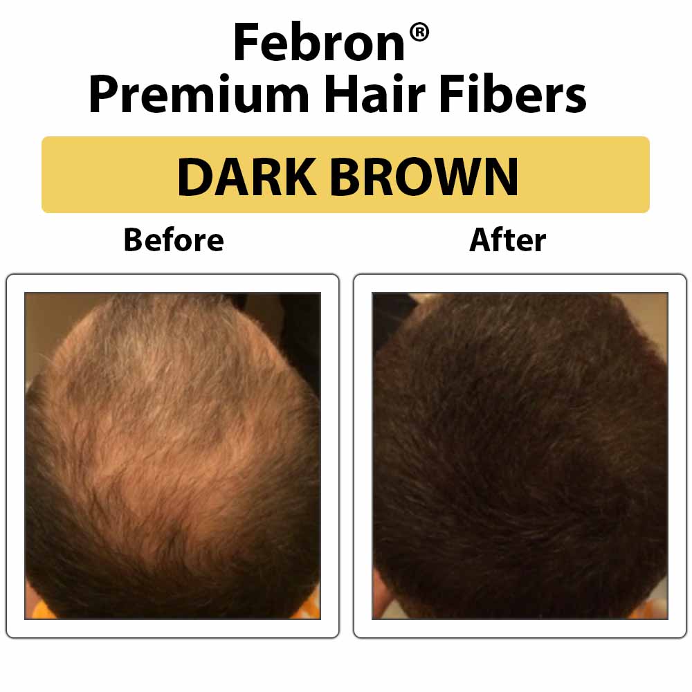 3 IN 1 Premium Febron Hair Building Fibers | Febron