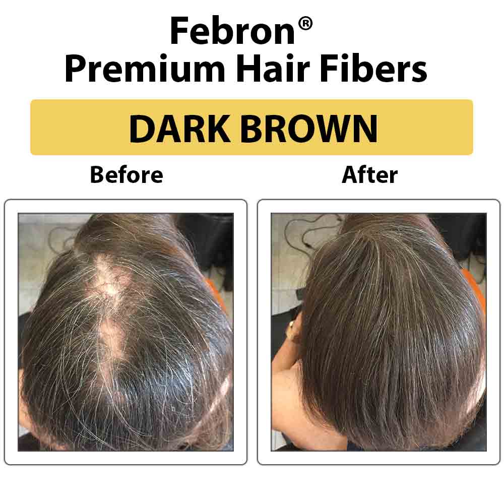 Febron® SILVER KIT 10% OFF | Hair Thickening Fibers Kit