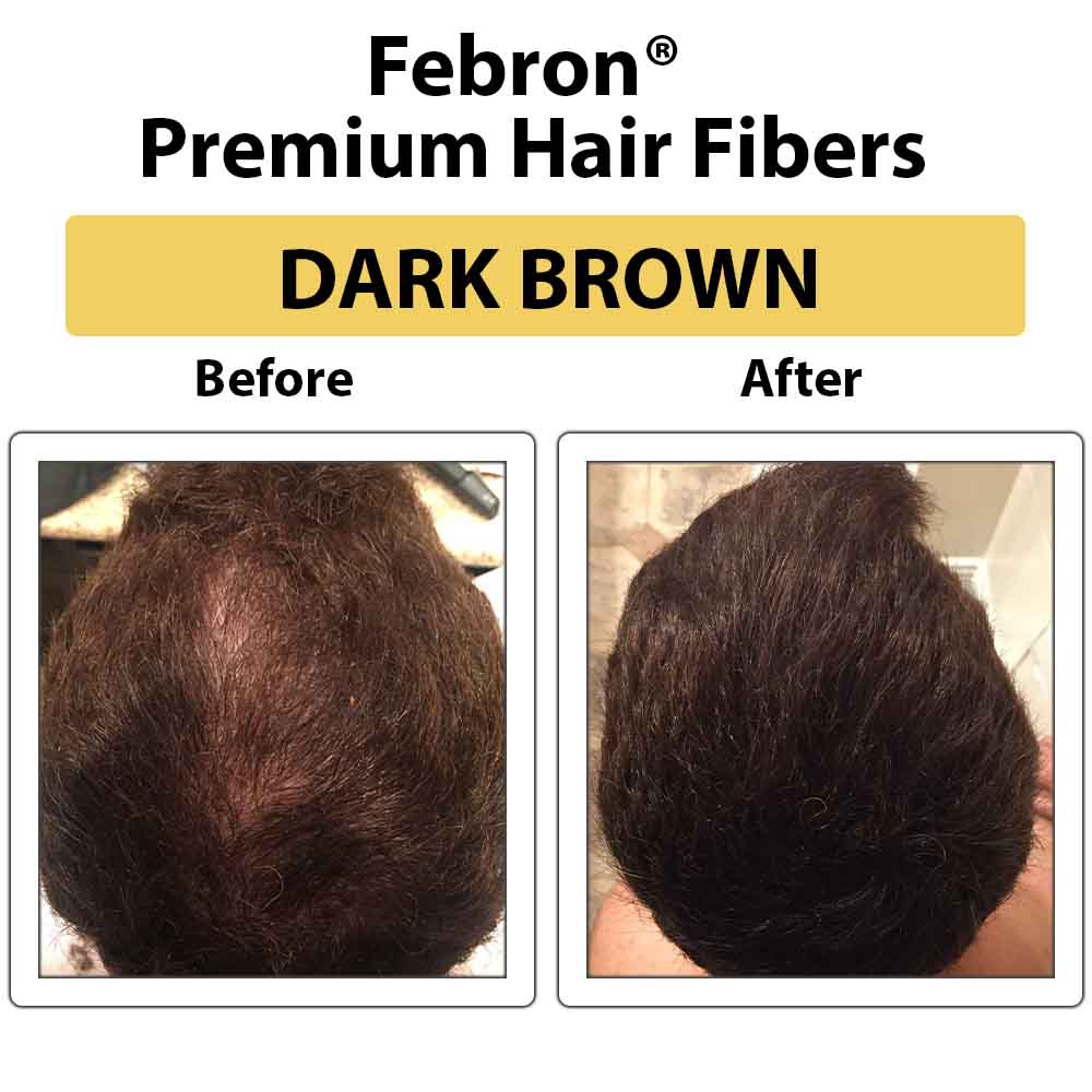 Febron® SILVER KIT 10% OFF | Hair Thickening Fibers Kit