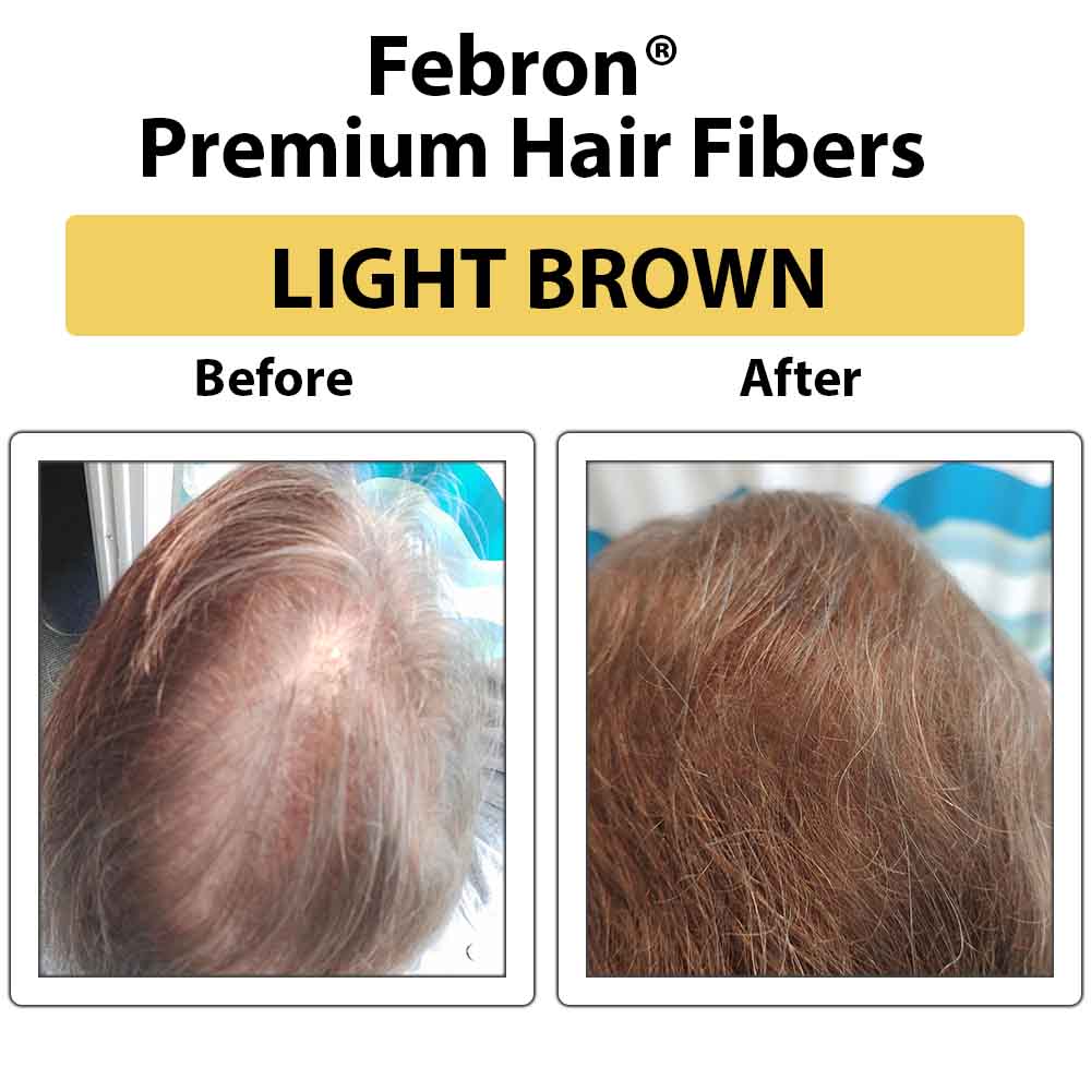 Febron® SILVER KIT 10% OFF | Hair Thickening Fibers Kit