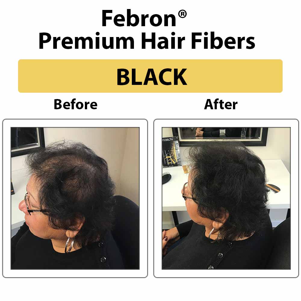 Febron® SILVER KIT 10% OFF | Hair Thickening Fibers Kit