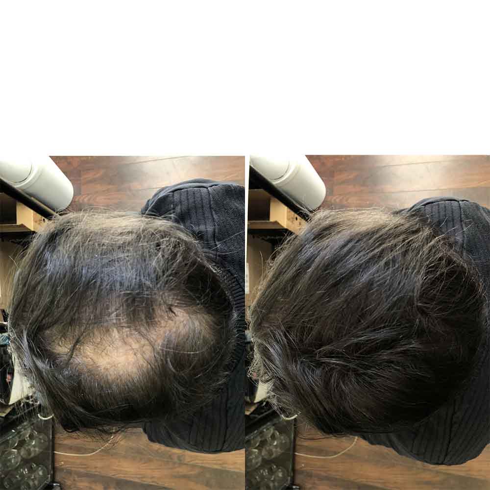 Febron® Hair Fibers Free Sample Thicker Fuller Hair in Seconds